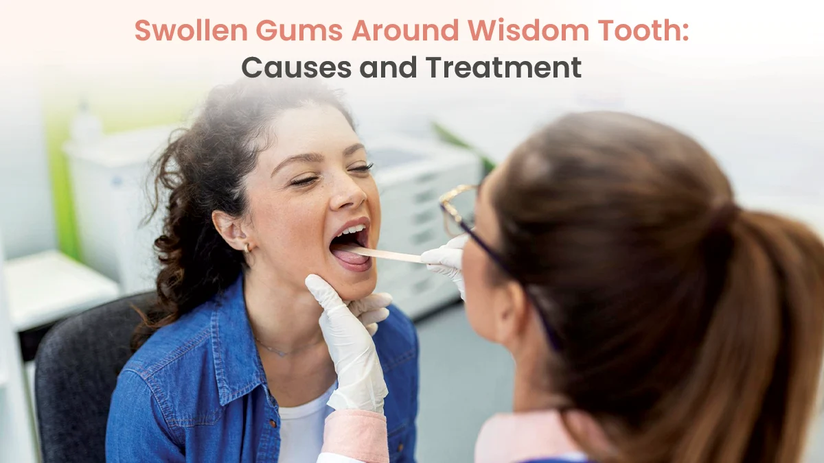 Swollen Gums Around Wisdom Tooth